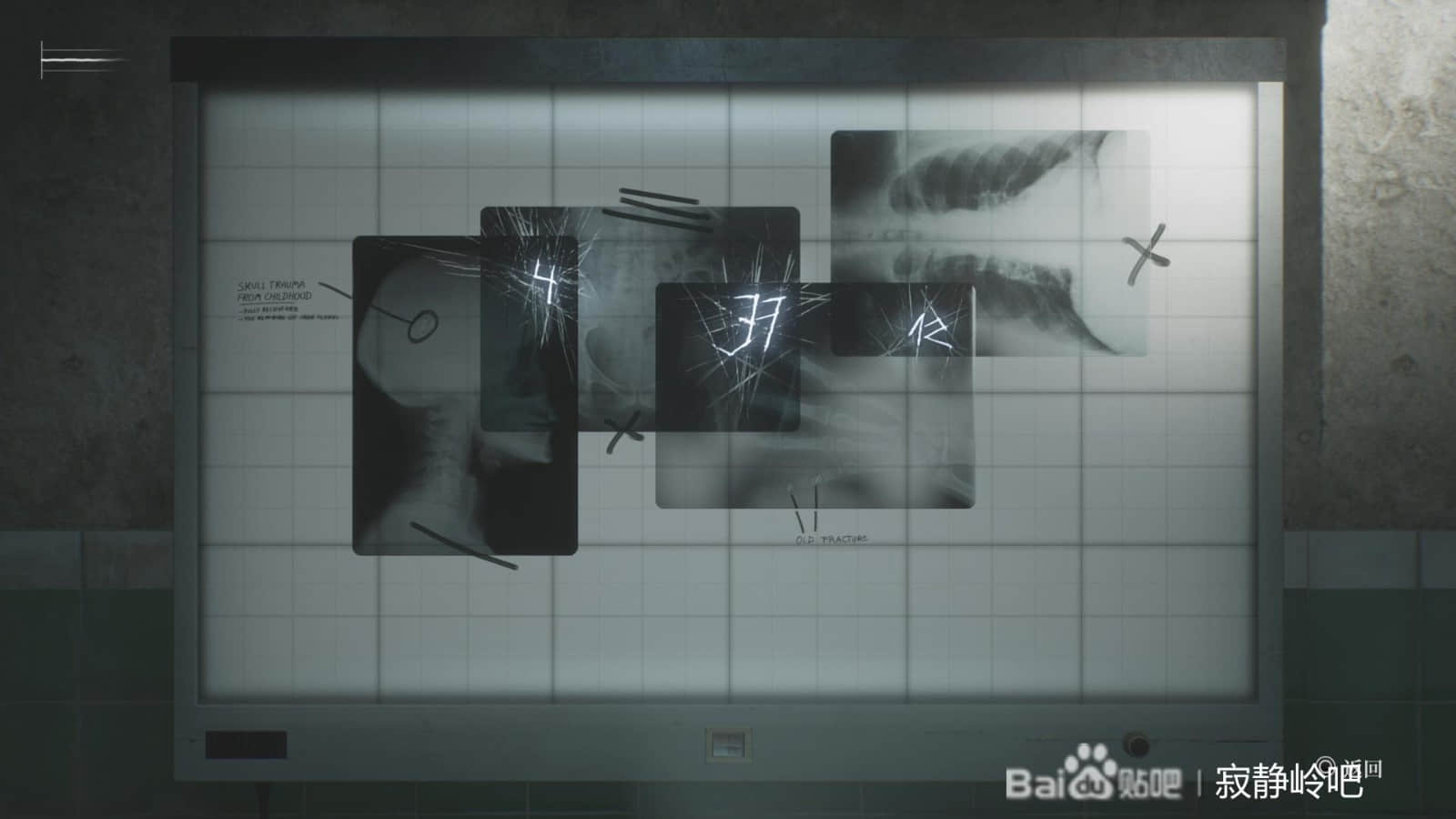 《寂静岭2：重制版》医院X光转盘锁密码解析